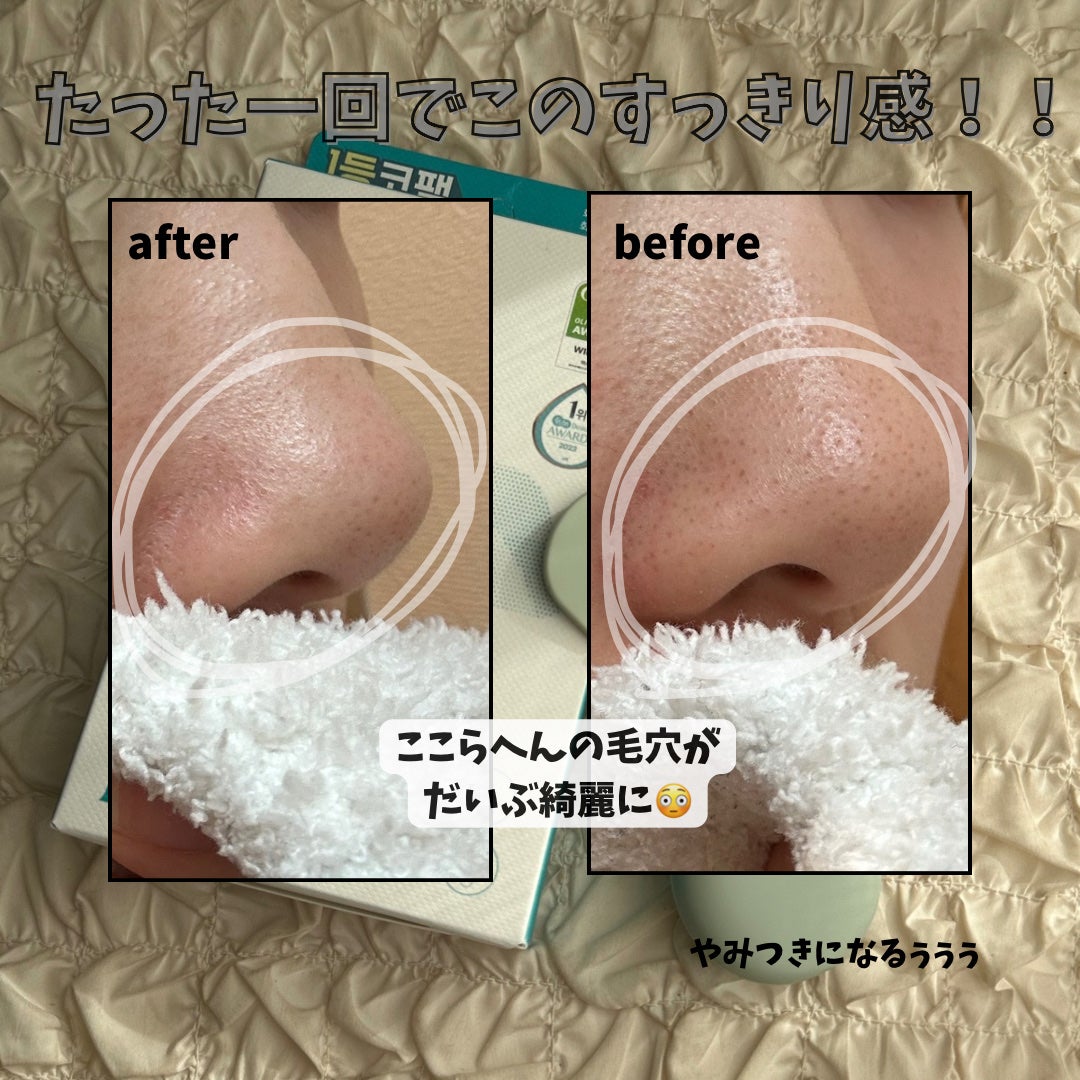 ナチュラルマイルドクリアノーズパック/ilso/シートマスク・パックを使ったクチコミ(4枚目)