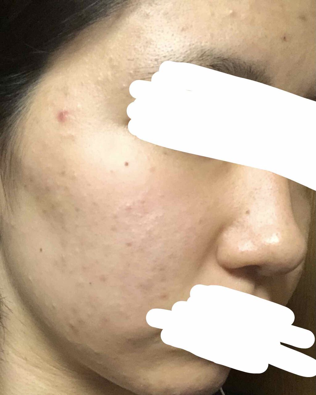 ハトムギ化粧水(ナチュリエ スキンコンディショナー R )/ナチュリエ/化粧水を使ったクチコミ（3枚目）