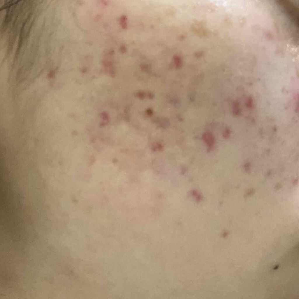 キールズ DS クリアリーブライト エッセンス[医薬部外品]/Kiehl's/美容液を使ったクチコミ（2枚目）