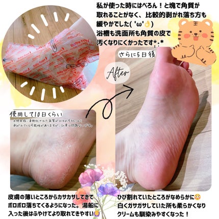 イージーパックDP60分タイプ/ベビーフット/レッグ・フットケアを使ったクチコミ(2枚目)