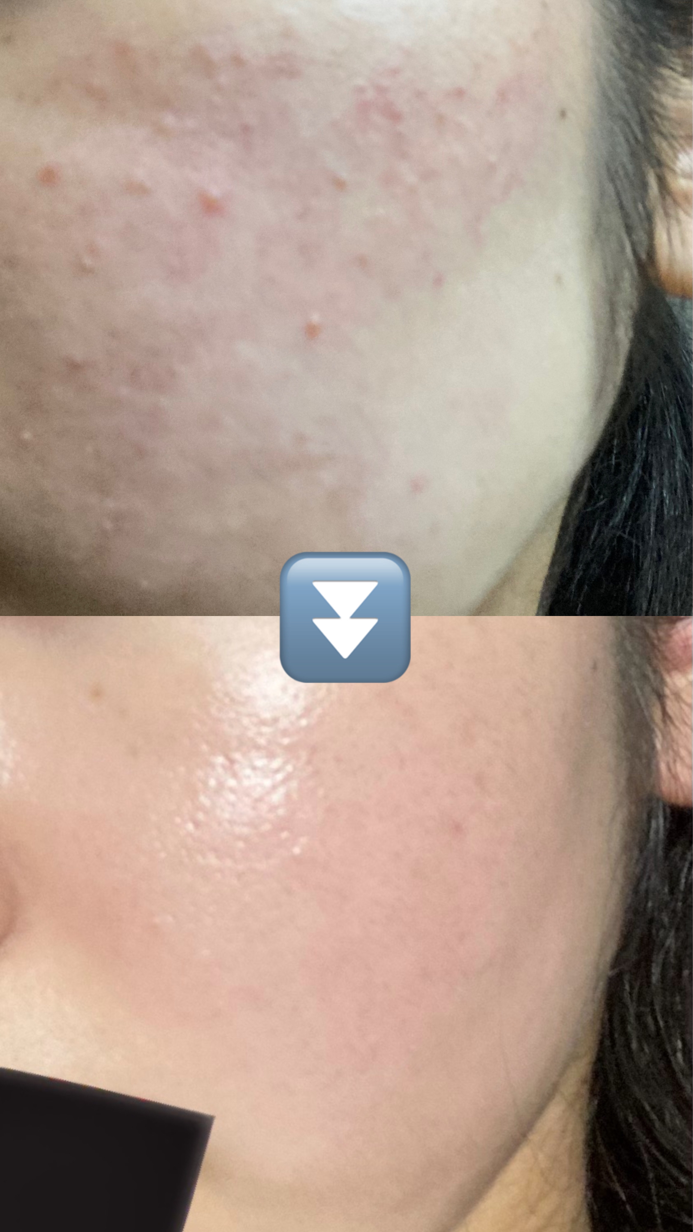 皮脂トラブルケア 化粧水/キュレル/化粧水を使ったクチコミ（2枚目）