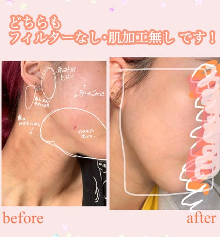 潤浸保湿 フェイスクリーム/キュレル/フェイスクリームを使ったクチコミ(3枚目)