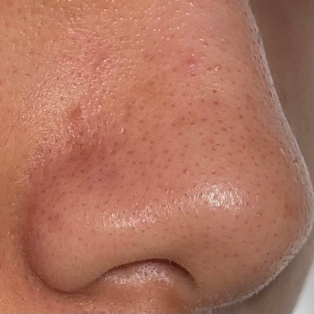 マイルドクレンジング オイル/ファンケル/オイルクレンジングを使ったクチコミ(3枚目)