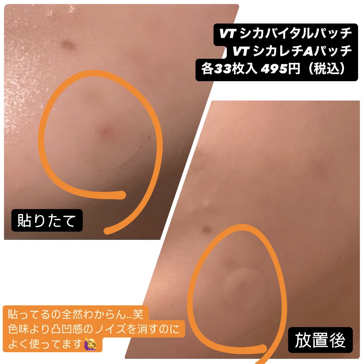 シカバイタルパッチ/VT/その他スキンケアを使ったクチコミ（2枚目）