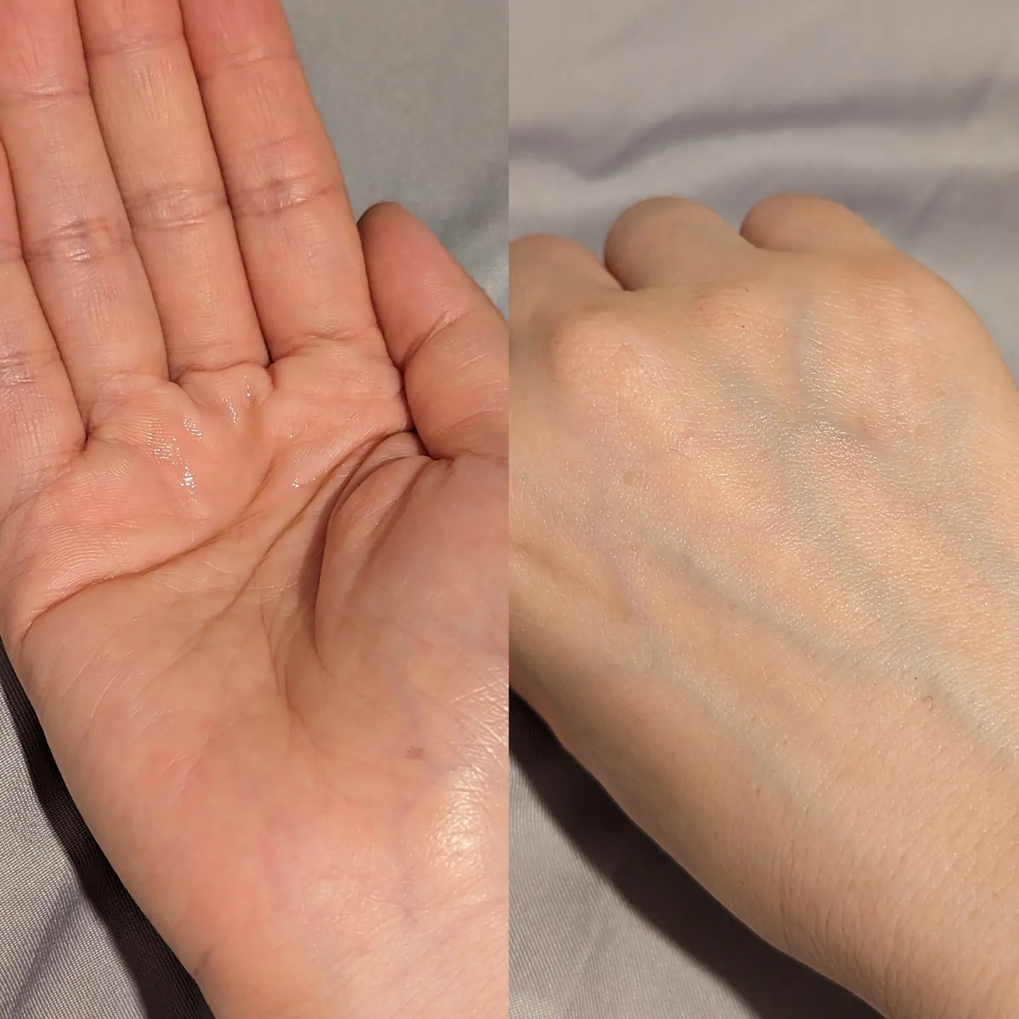 センテラ アンプル/SKIN1004/美容液を使ったクチコミ（2枚目）