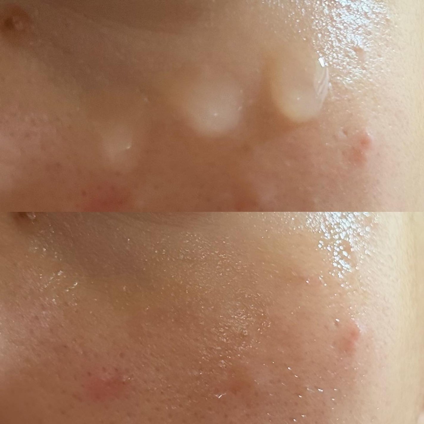 エイシカ365マイクロセラム/AESTURA/美容液を使ったクチコミ(6枚目)