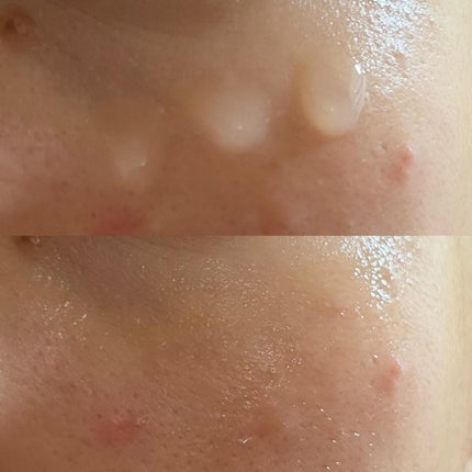 エイシカ365マイクロセラム/AESTURA/美容液を使ったクチコミ(6枚目)