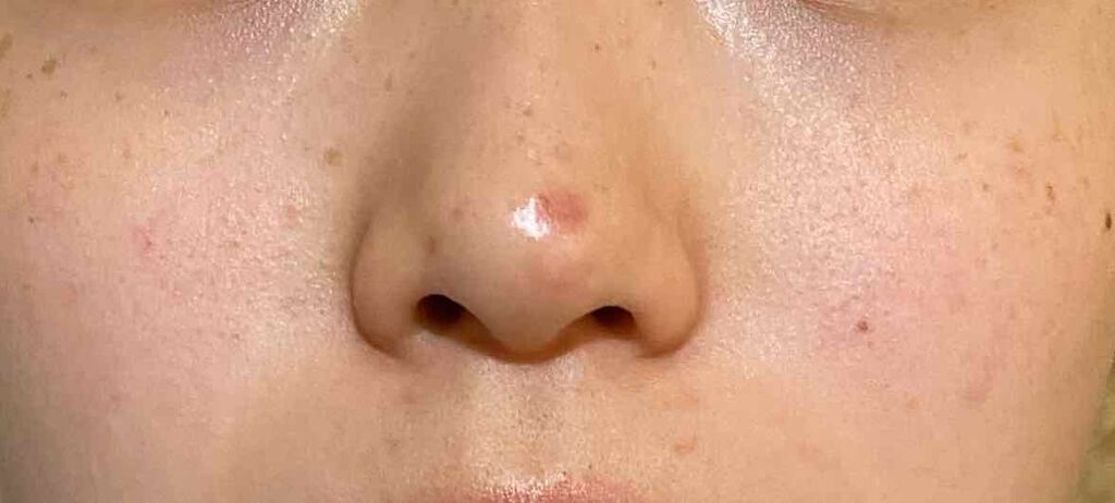 化粧水 敏感肌用 さっぱりタイプ/無印良品/化粧水を使ったクチコミ(4枚目)