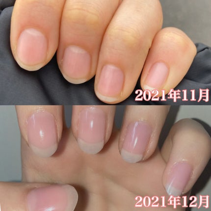 ネイルトリートメント N/ネイルネイル/ネイルオイル・トリートメントを使ったクチコミ(2枚目)