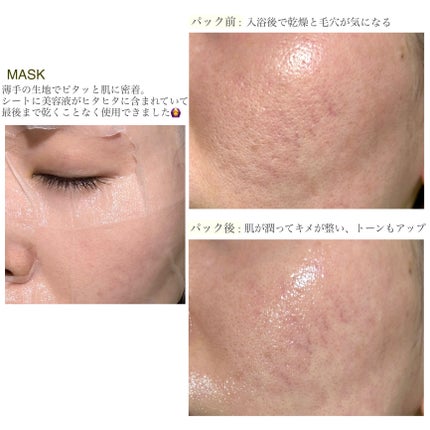 ナイアシンアミドグルタチオンセラム/ONE THING/美容液を使ったクチコミ(3枚目)