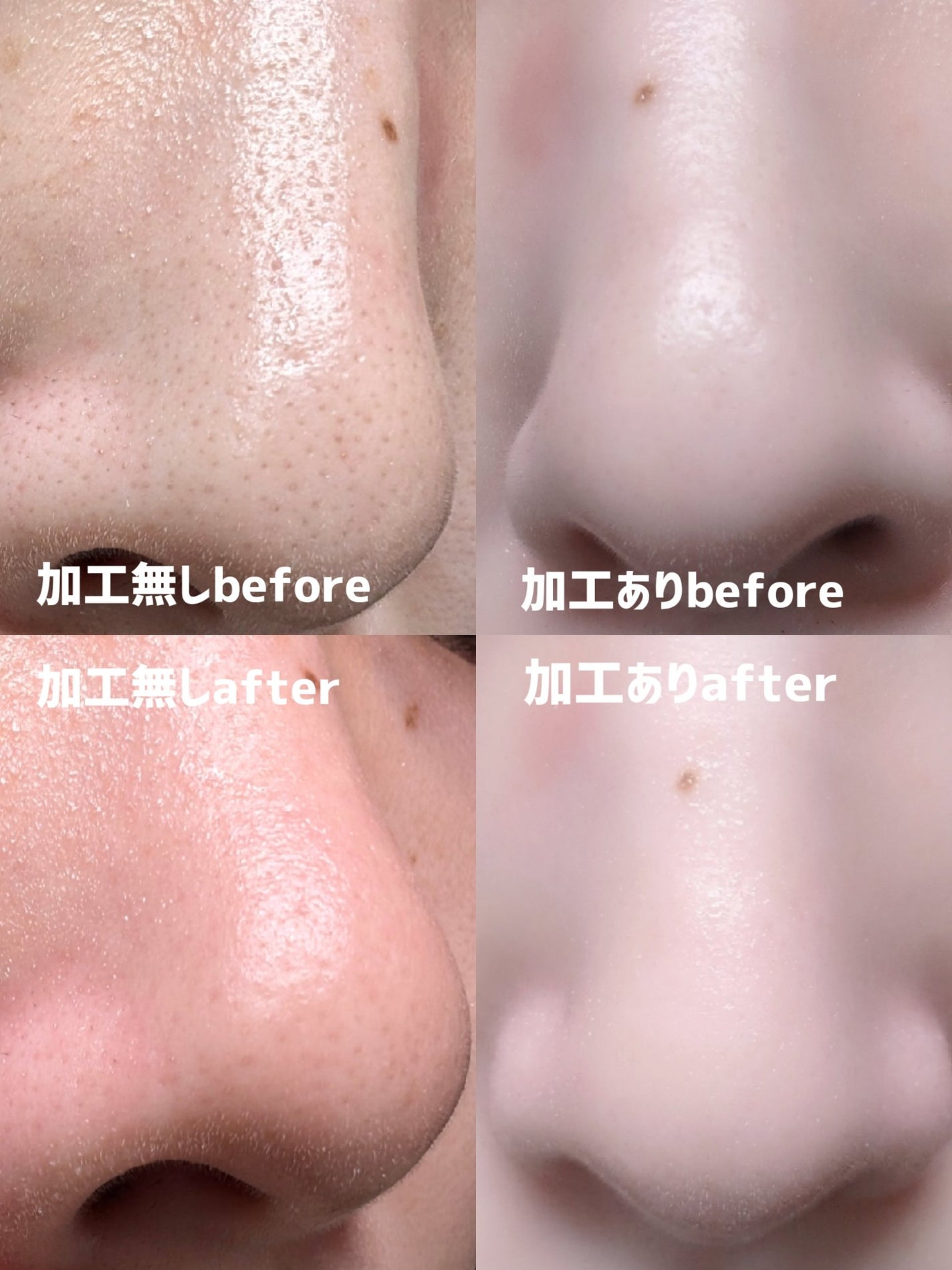 ナチュラルマイルドクリアノーズパック/ilso/シートマスク・パックを使ったクチコミ(8枚目)