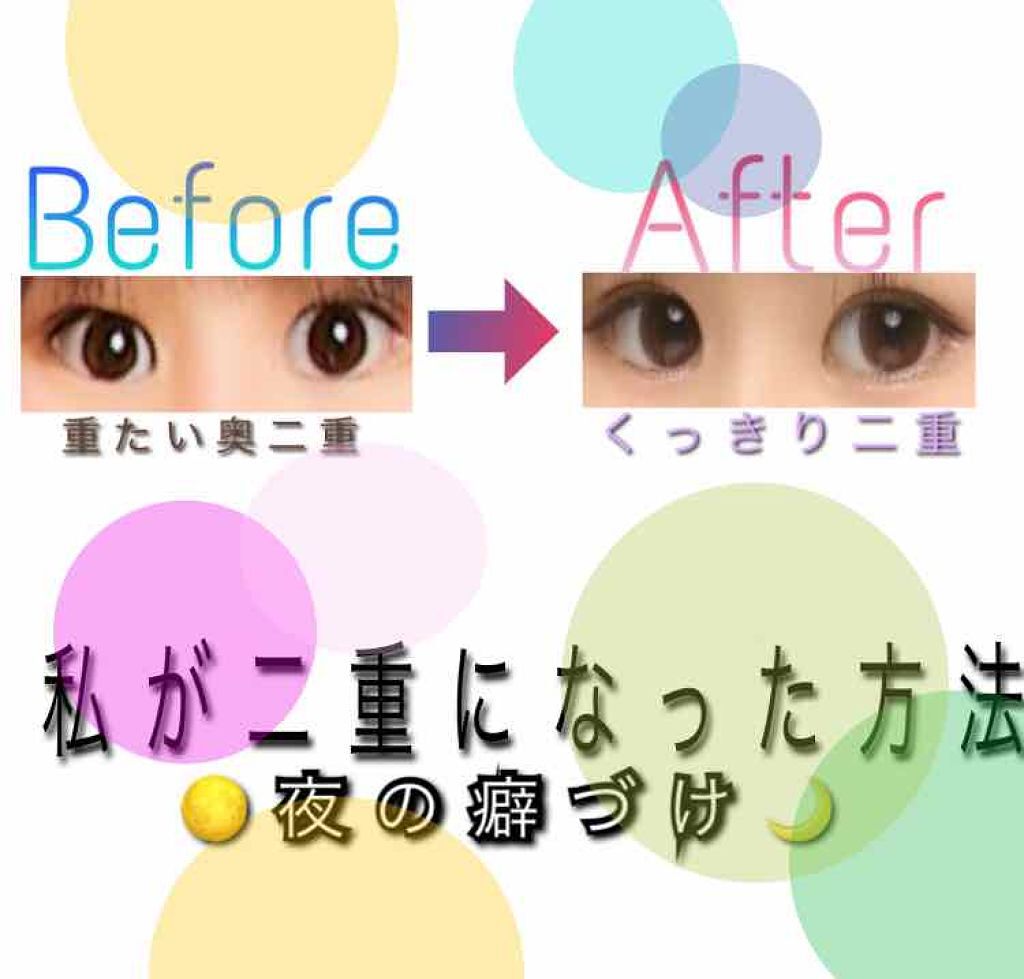 ふたえテープ 目立たず肌になじむ絆創膏タイプ/DAISO/二重まぶた用アイテムを使ったクチコミ（1枚目）