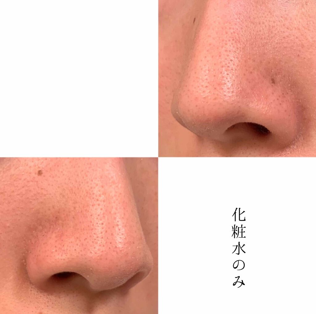 艶肌ドロップ/ラッシュ/美容液を使ったクチコミ（3枚目）