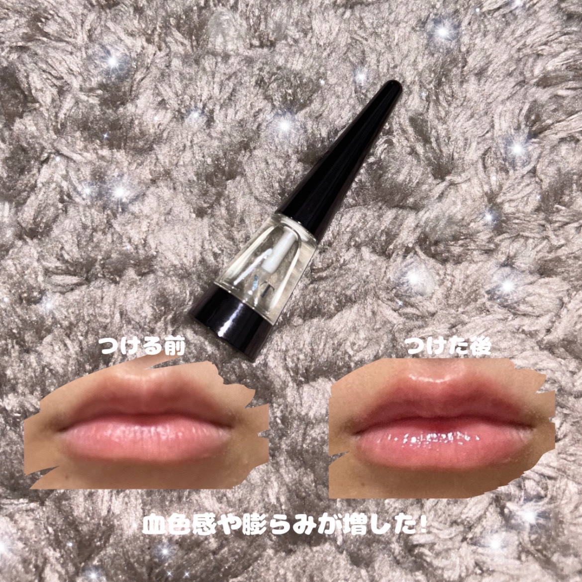 リードルS リッププランパーエキスパート/VT/リッププランパーを使ったクチコミ（2枚目）