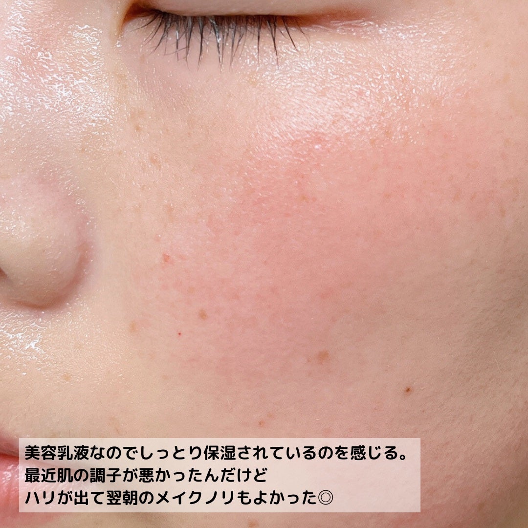 ドクタールルルン スキンブースト EX マスク/ルルルン/シートマスク・パックを使ったクチコミ(6枚目)