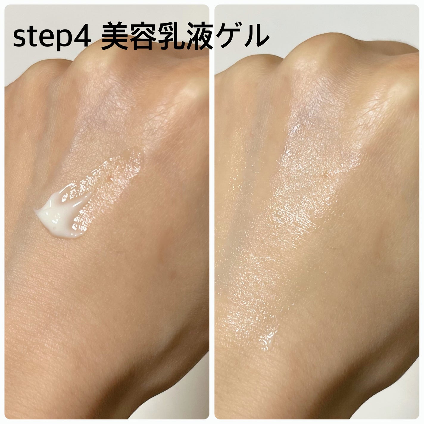 アンプルール トライアルキット/アンプルール/トライアルキットを使ったクチコミ(6枚目)