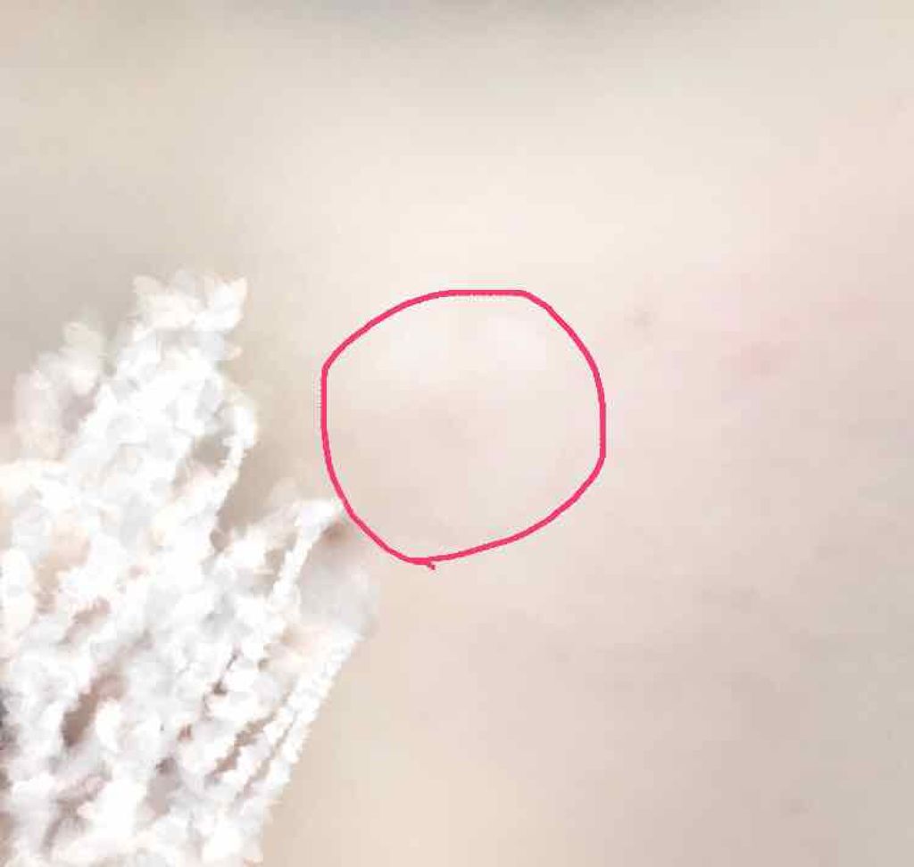 ACC パッチ/ETUDE/シートマスク・パックを使ったクチコミ（3枚目）