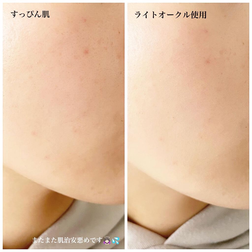 ミネラルエアースターターセット/NIMERAL air/その他ファンデーションを使ったクチコミ(5枚目)