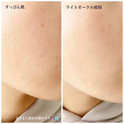 ミネラルエアースターターセット/NIMERAL air/その他ファンデーションを使ったクチコミ(5枚目)