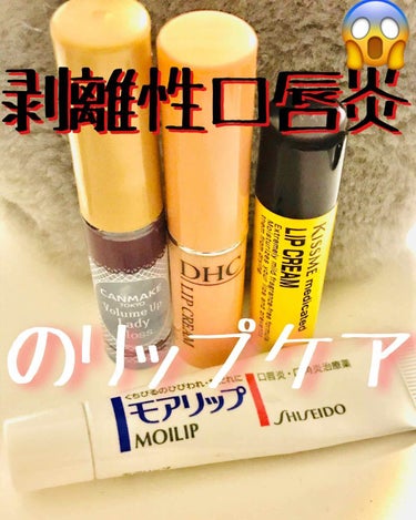 モアリップ N (医薬品)/資生堂薬品/リップケア・リップクリームを使ったクチコミ（1枚目）