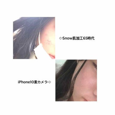 ﾙ on LIPS 「ニキビにはもうお金かけたくない😖そんな貴方~‼︎是非読んでみて..」（2枚目）