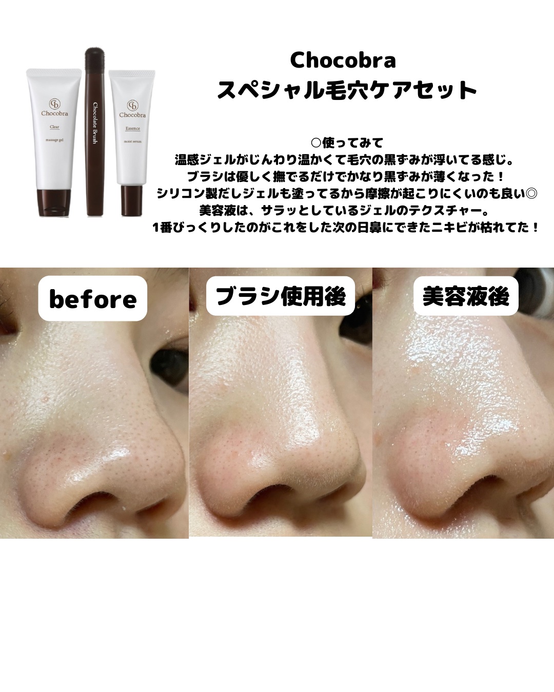 チョコブラ スペシャル毛穴ケアセット｜Chocobraの口コミ - Chocobra
