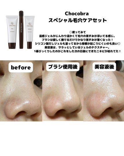 チョコブラ スペシャル毛穴ケアセット/Chocobra/スキンケアキットを使ったクチコミ(3枚目)