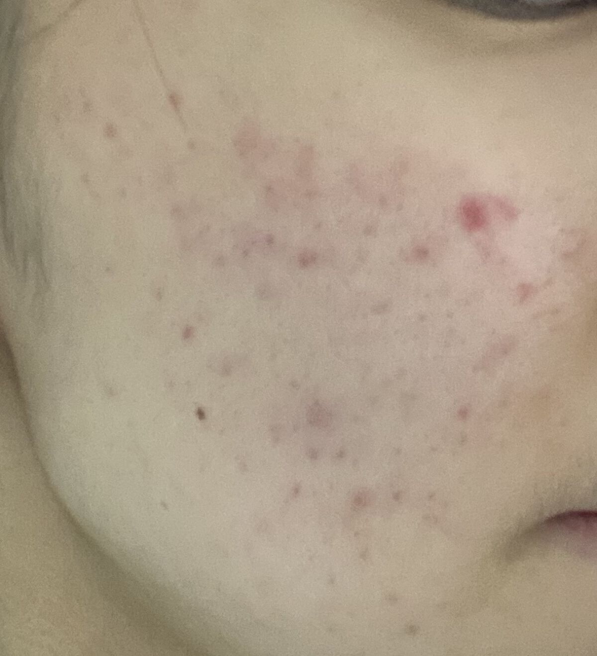 BCローション/DAISO/美容液を使ったクチコミ（2枚目）