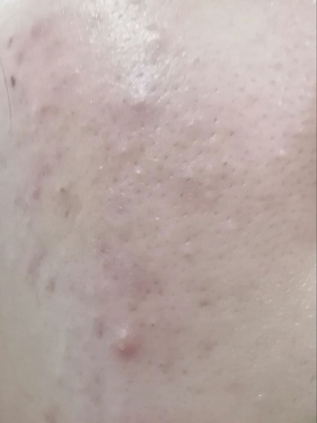 もちょ on LIPS 「初めまして、高校1年生の梅本です。ピッチピチのJKになれるよう..」(2枚目)