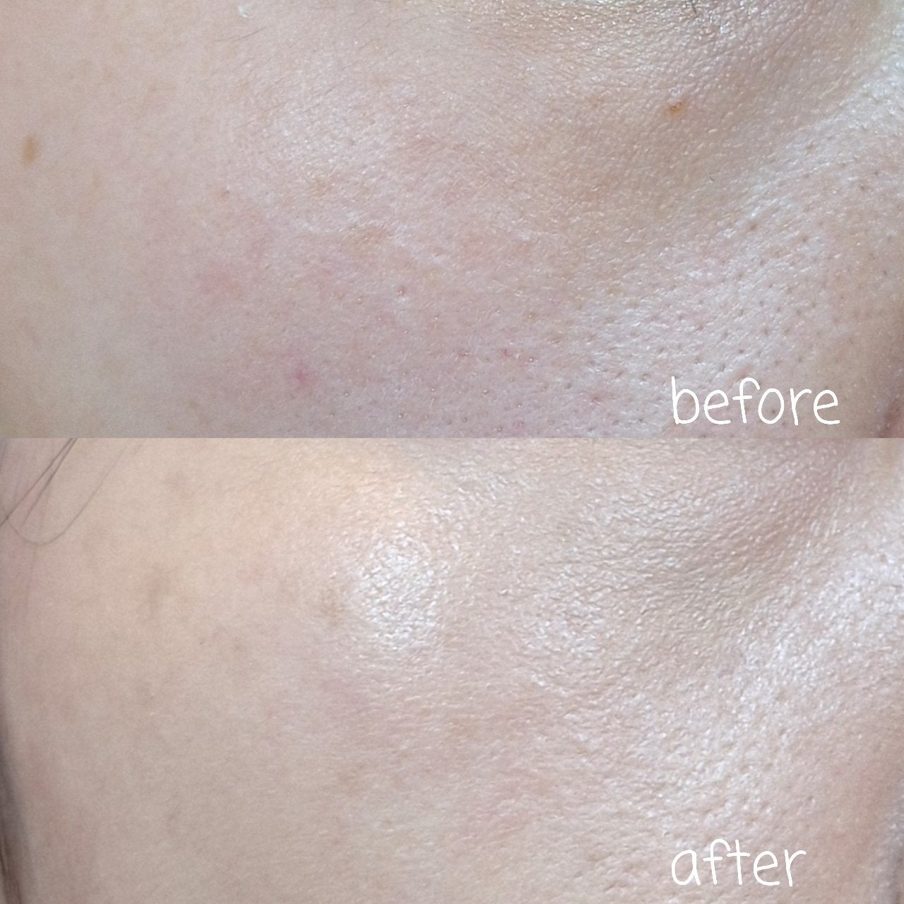 ヴェールヌーディ エッセンスパクトグロウ/AGE20’s/クリーム・エマルジョンファンデーションを使ったクチコミ(3枚目)