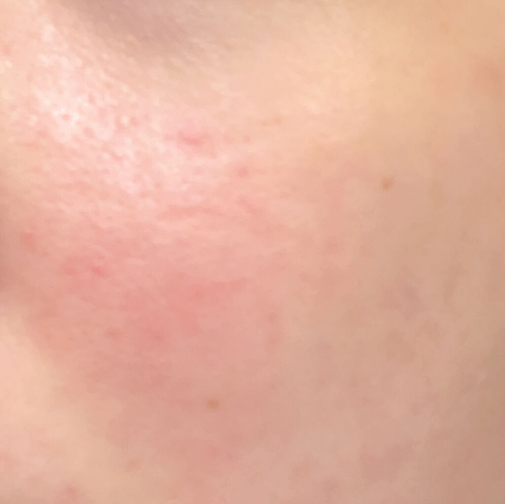 ガラクトミセスピュアビタミンCグロートナー/SOME BY MI/化粧水を使ったクチコミ（3枚目）