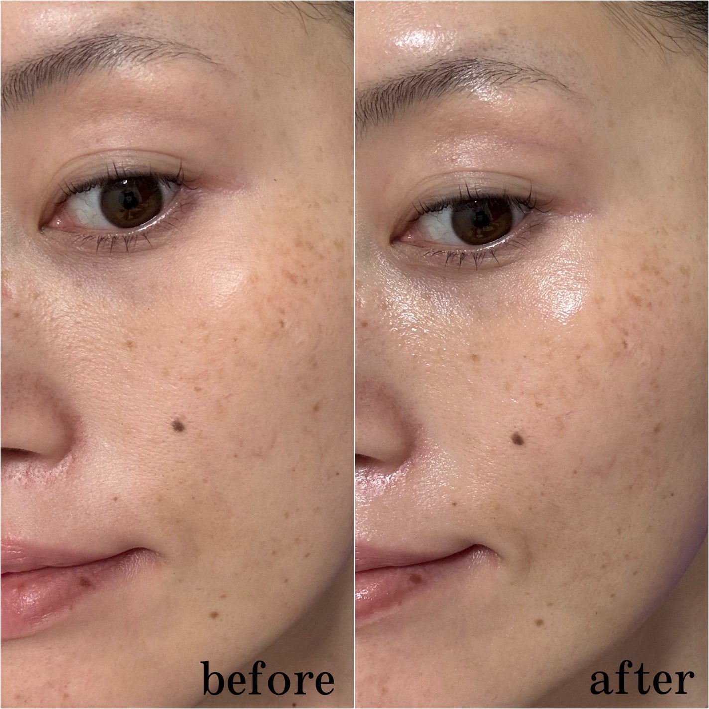 MELALESS AMPOULE/WONJIN EFFECT/美容液を使ったクチコミ(5枚目)