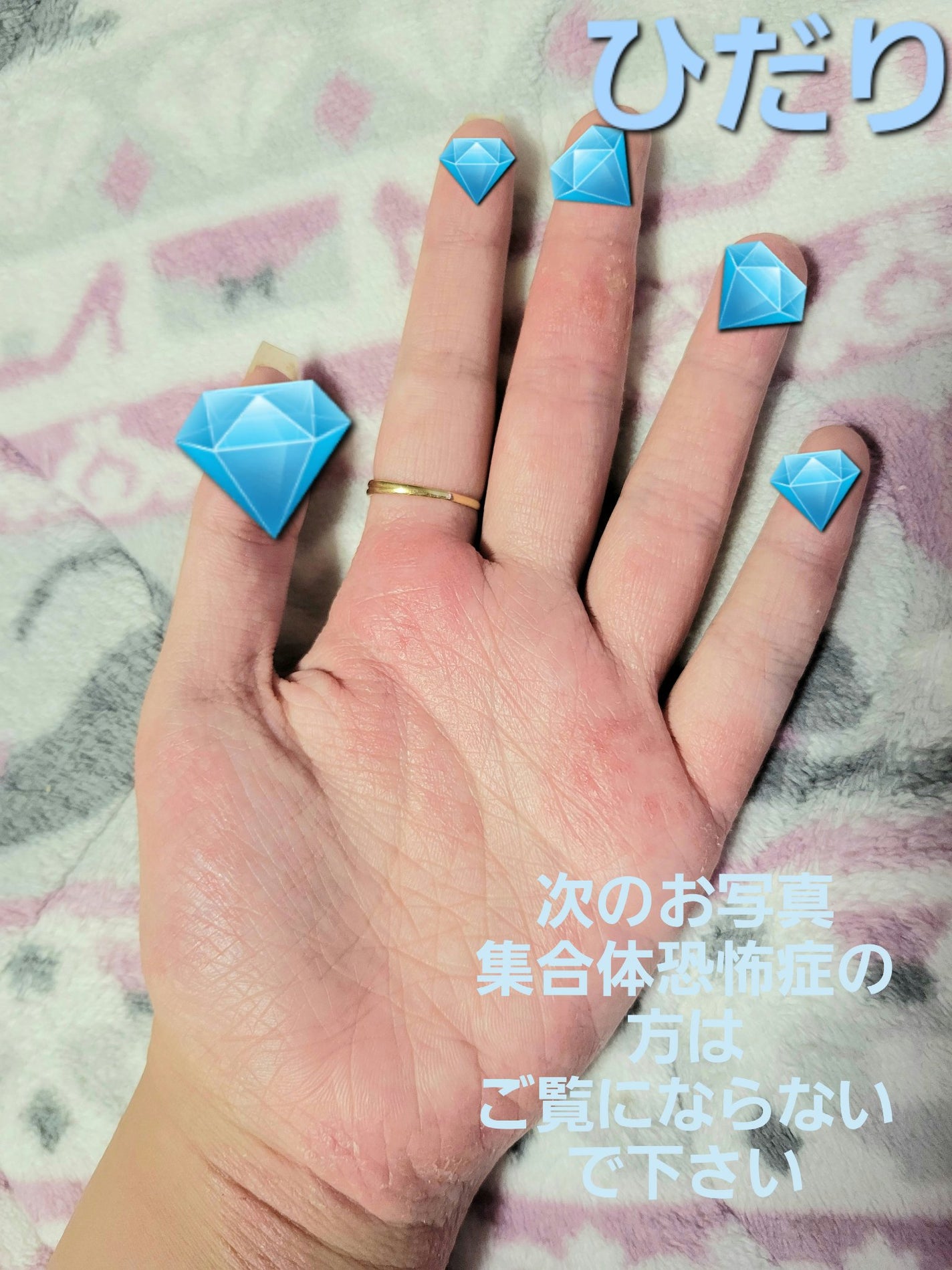 ニベアクリーム/ニベア/ボディクリームを使ったクチコミ(7枚目)