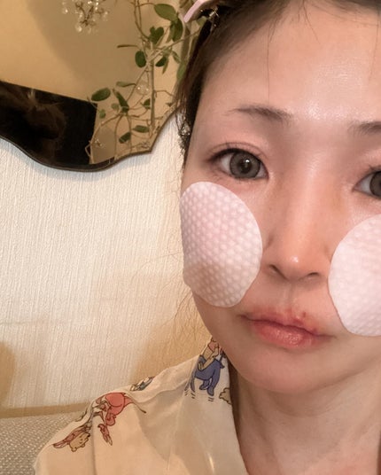 ゼロ毛穴パッド 2.0/MEDICUBE/トナーパッドを使ったクチコミ(5枚目)