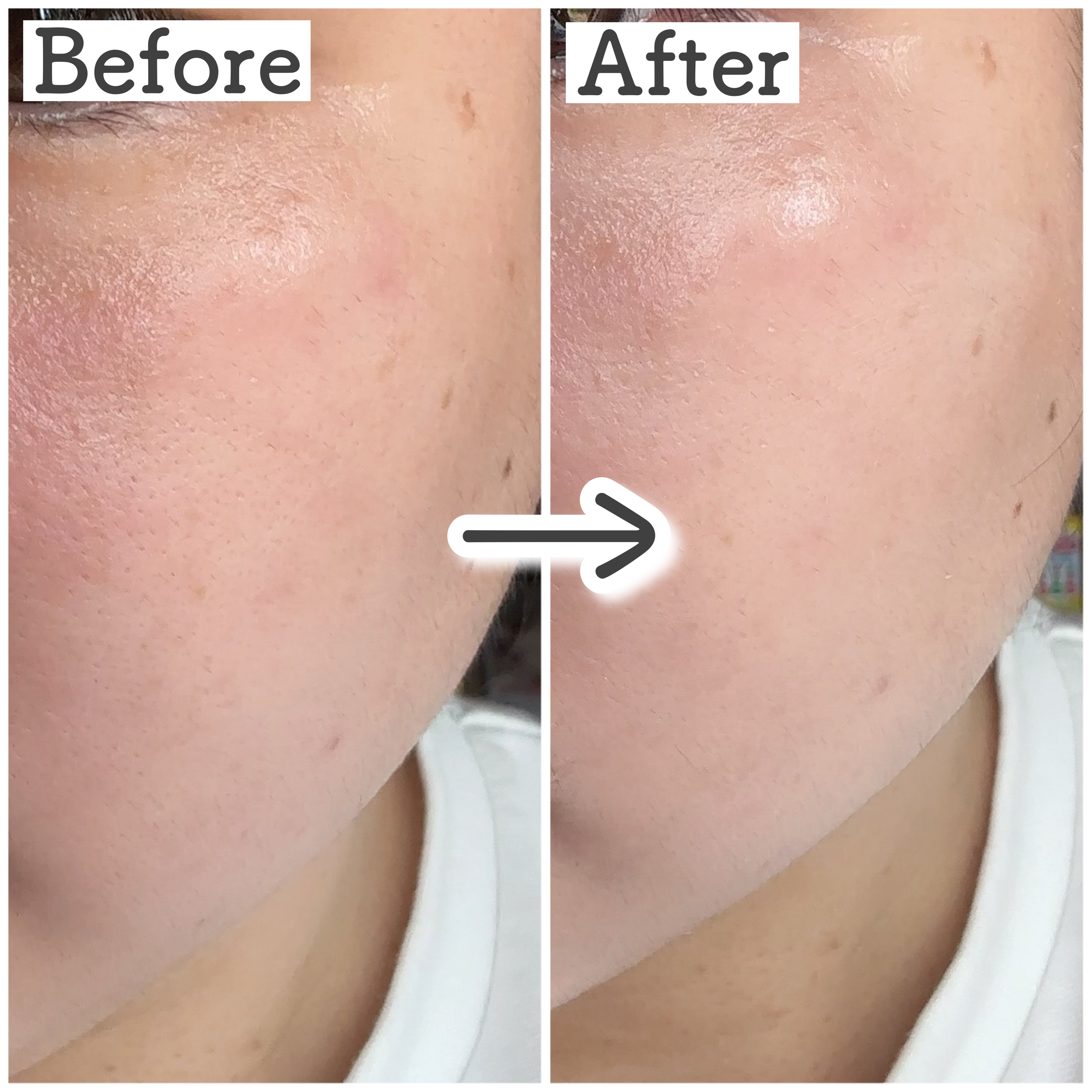 ハイドラアンプルⅡ/9Wishes/美容液を使ったクチコミ（3枚目）