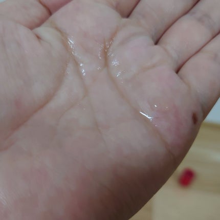 薬用 RJ地肌ケア エッセンス /アピセラピーコスメティクス/頭皮ローションを使ったクチコミ(4枚目)