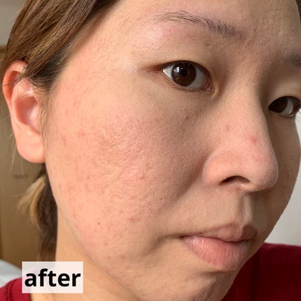 薬用シークレットビューティーパウダー/キャンメイク/フェイスパウダーを使ったクチコミ(9枚目)