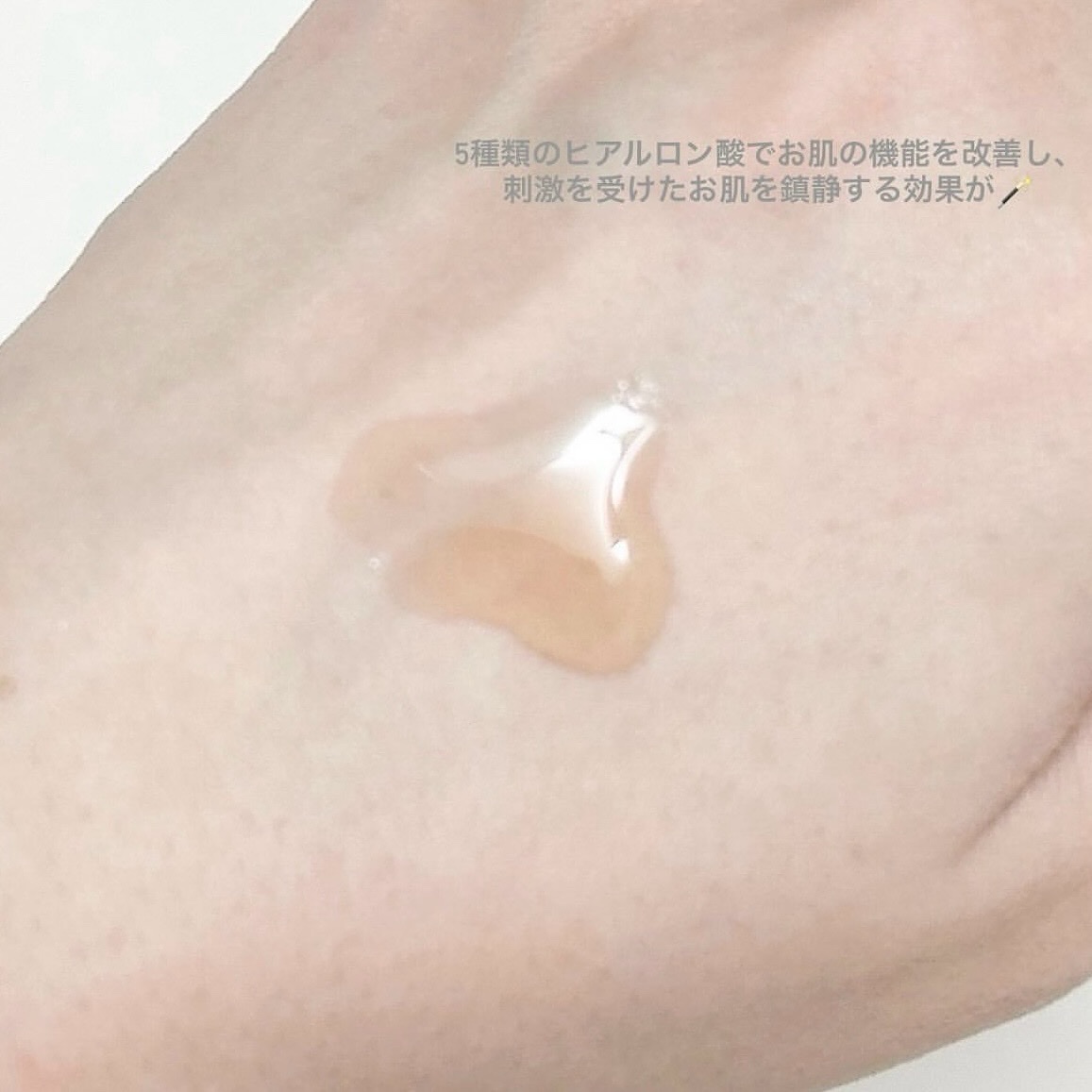 RXザ・アルファアルブチン2 ニキビ跡ケアセラム/COSRX/美容液を使ったクチコミ（3枚目）