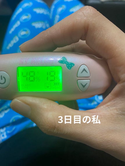 NEW美ルルスキンチェッカー/belulu/美顔器・マッサージを使ったクチコミ(8枚目)