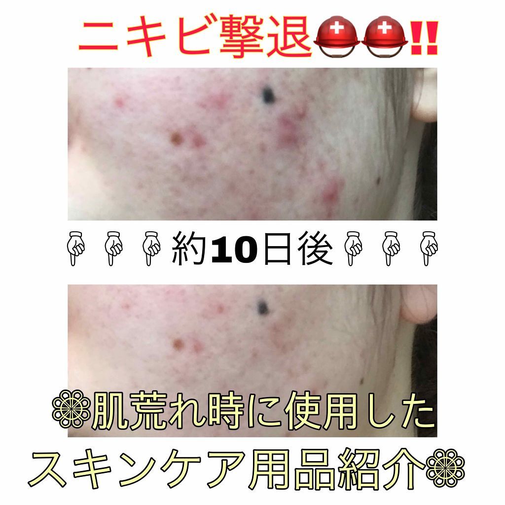 おうちdeエステ 肌をなめらかにする マッサージ洗顔ジェル/ビオレ/その他洗顔料を使ったクチコミ（1枚目）