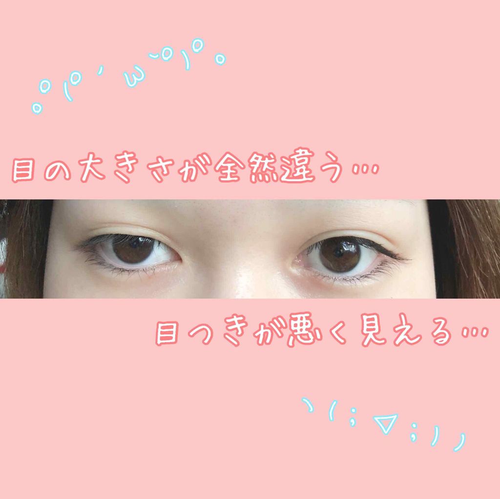 アイテープ(絆創膏タイプ、レギュラー、70枚)/DAISO/二重まぶた用アイテムを使ったクチコミ(2枚目)
