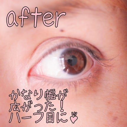 メザイク クリップ カッター ファイバー専用カッター/メザイク/二重まぶた用アイテムを使ったクチコミ(7枚目)