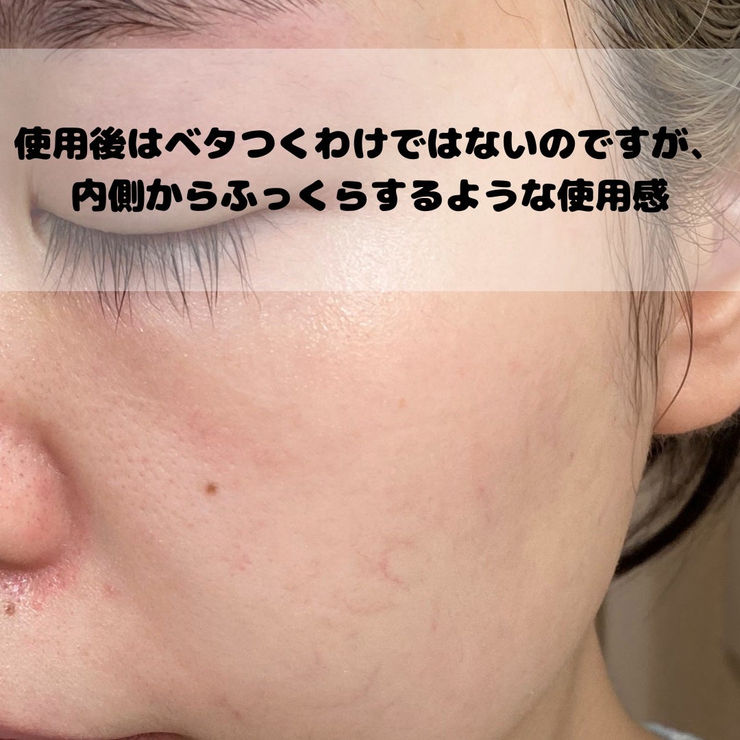 ザ・ダーママスク /クオリティファースト/シートマスク・パックを使ったクチコミ(5枚目)