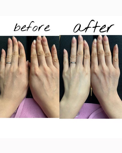 セラムエクラS/クレ・ド・ポー ボーテ/美容液を使ったクチコミ(2枚目)