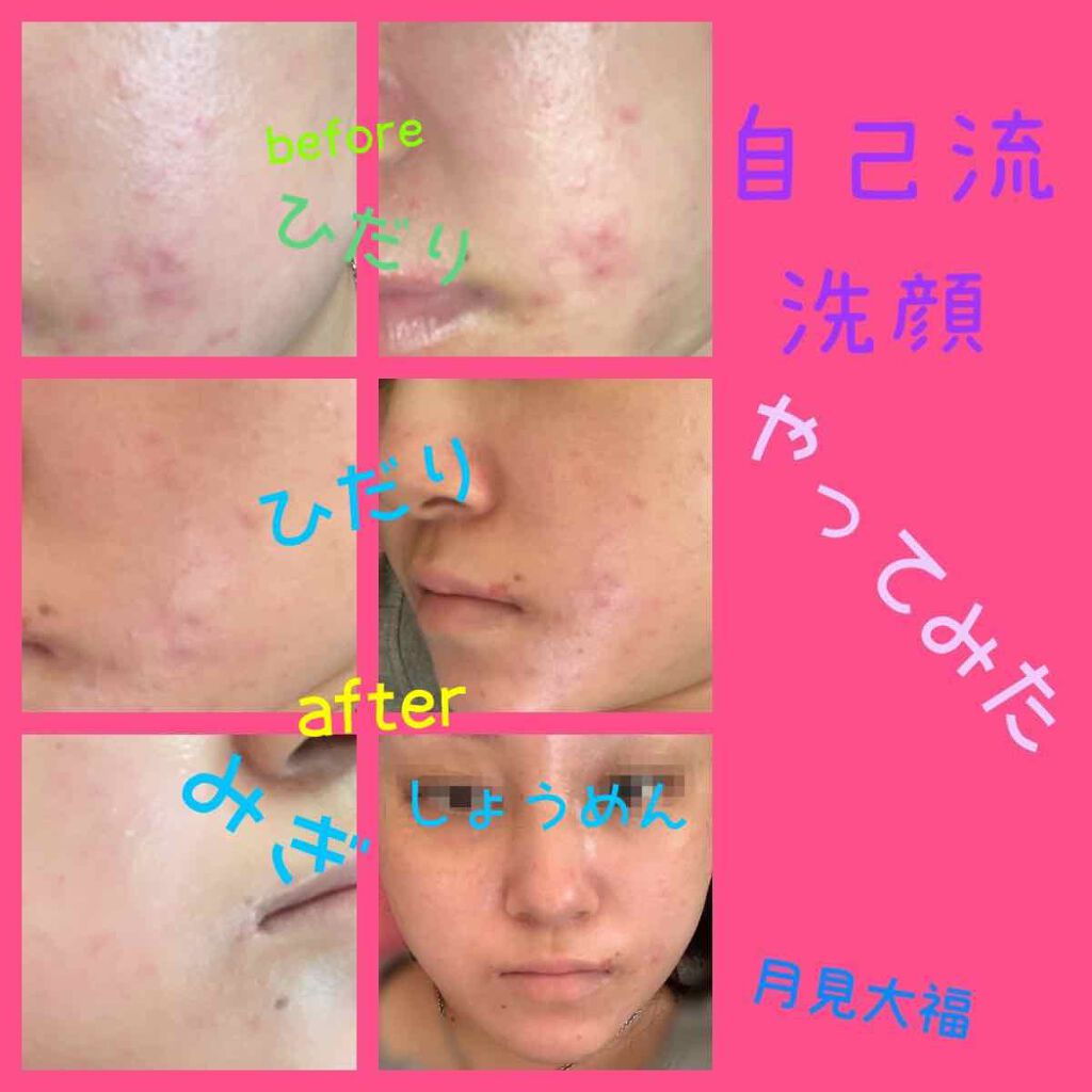 月見大福 on LIPS 「*自己流ワセリン拭き取り洗顔*味覚過敏による酷い偏食。過敏性腸..」(2枚目)