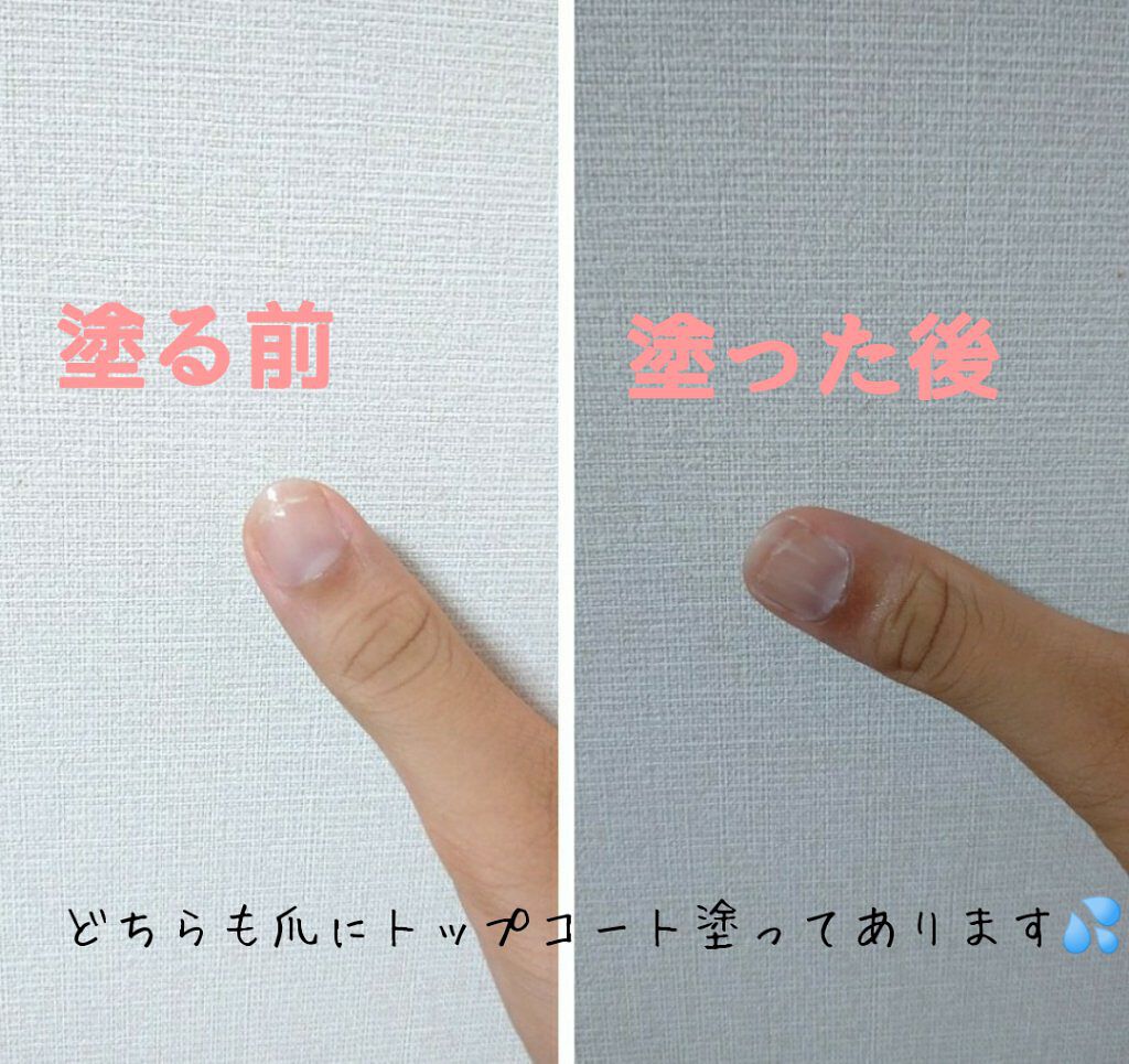 ネイルトリートメント N/ネイルネイル/ネイルオイル・トリートメントを使ったクチコミ(3枚目)