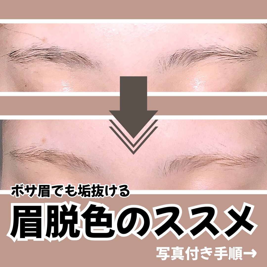 脱色クリーム スピーディー/エピラット/ムダ毛ケアを使ったクチコミ（1枚目）