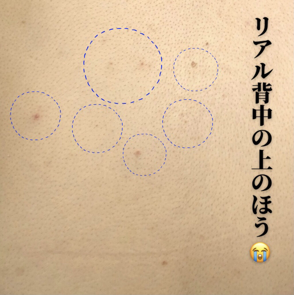 セナキュア(医薬品)/小林製薬/その他を使ったクチコミ（2枚目）