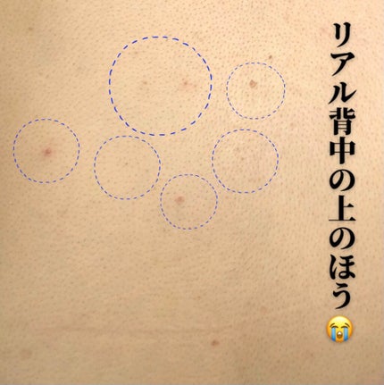 セナキュア(医薬品)/小林製薬/その他を使ったクチコミ(2枚目)