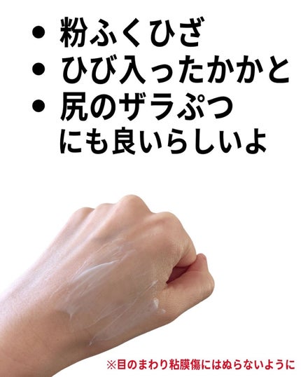 U20クリーム(医薬品)/メンターム/その他を使ったクチコミ(6枚目)